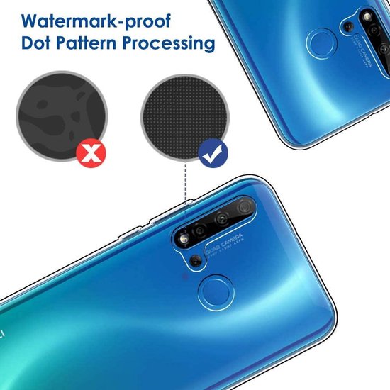 Huawei P20 Lite 2019 Hoesjes – Soft TPU Siliconen Backcover – 2x Gehard Glas Screenprotector – Transparant-Ilumina Benelux