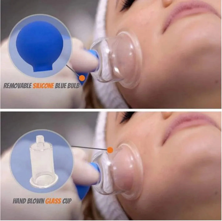 Facial cupping set – Siliconen vacuüm massage cups – Lymfedrainage & anti-cellulite – Voor ogen, gezicht en lichaam – Roze-Ilumina Benelux
